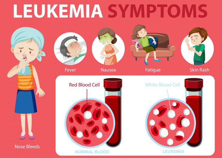 Symptoms of Leukemia - Medistine